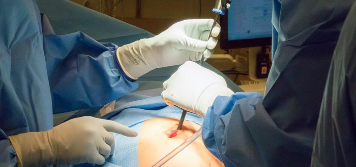 Что такое криозаморозка ооцитов?